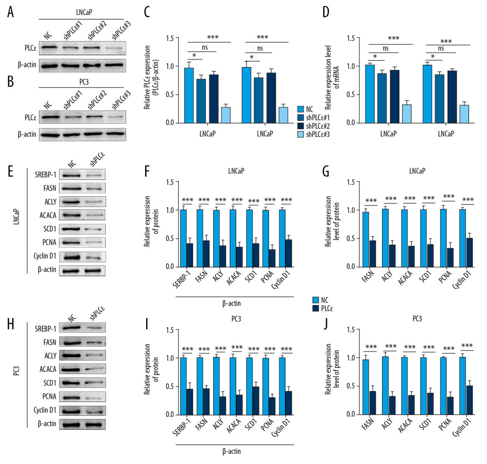Silencing PLCɛ suppresses proliferation-related factors and fatty acid synthesis-related enzymes in PCa cell lines. (A–D) PC3 and LNCap cells treated with 3 types of lentivirus for knocking down PLCɛ, and the PLCɛ protein and mRNA levels were detected by Western blot and qPCR. (E–J) Knockdown of PLCɛ decreased the protein and mRNA levels of lipid metabolism-related enzymes and proliferation-related factors in PCa cells using Western blot and qPCR vs. NC.