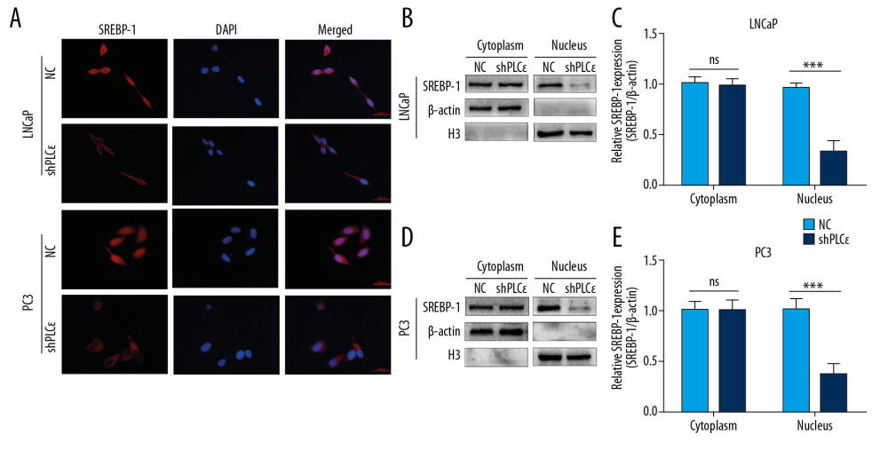 Silencing PLCɛ blocks SREBP-1 nuclear translocation. (A) Immunofluorescence staining revealed SREBP-1 intracellular distribution changes in LNCap and PC3 cells. (B–E) Western blot illustrated that silencing PLCɛ observably downregulates SREBP-1 expression in the nucleus but not in the cytoplasm in the 2 PCa cell lines.