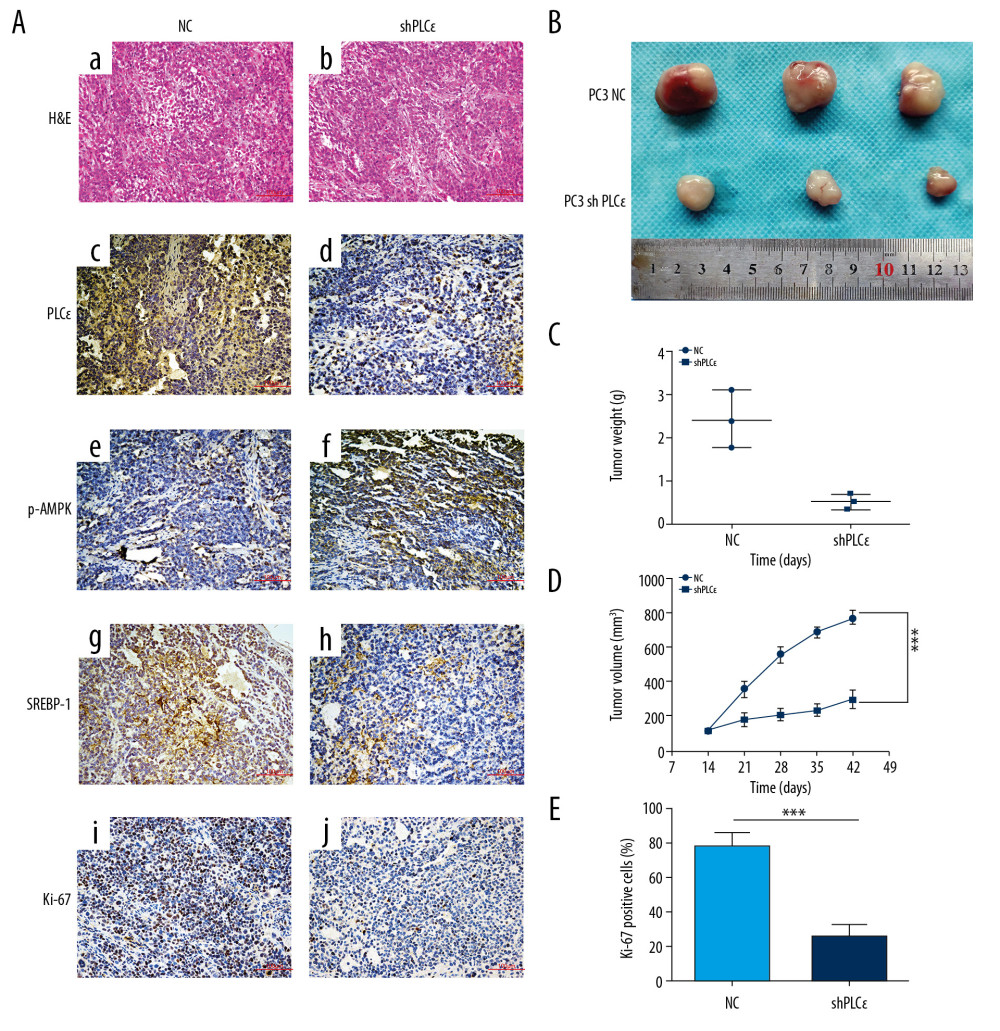 Silencing PLCɛ suppresses lipid metabolism and proliferation of PC3 cells in vivo. (A) Immunohistochemical assays were used to detect the expression of PLCɛ, p-AMPK, SREBP-1, and Ki67 in silenced PLCɛ and NC group (200×,100 μm bar) (a–j). (B–D) Tumor size, weight, and dynamic volume were measured. (E) Ki67 was quantified in NC and knockdown PLCɛ groups. *** p<0.001, ns – no statistical significance; NC – negative bontrol.