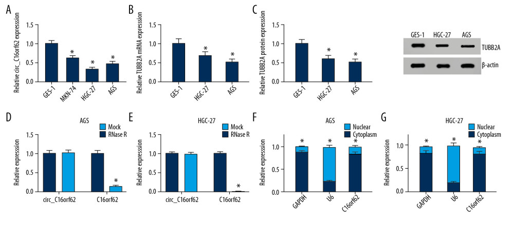 Circ_C16orf62 was expressed at low level in GC cells. (A) Expression of circ_C16orf62 in human normal gastric epithelial cell line (GES-1) and GC cell lines (MKN-74, HGC-27 and AGS) detected by RT-qPCR assay. (B, C) TUBB2A levels in human normal gastric epithelial cell line (GES-1) and GC cell lines (HGC-27 and AGS) were measured by RT-qPCR and western blot assays. (D, E) Relative levels of circ_C16orf62 and C16orf62 mRNA were tested in HGC-27 and AGS cells treated with or without RNase R. (F, G) The cellular localization of circ_C16orf62 in AGS and HGC-27 cells was analyzed by subcellular fractionation assay. * P<0.05.
