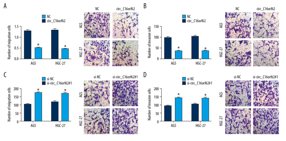 Circ_C16orf62 repressed migration and invasion of GC cells in vitro. (A, B) Transwell migration assay was applied to assess the capacity of migration and in NC or circ_C16orf62-transfected H460 and A549 cells. (C, D) Invasion ability was measured by transwell invasion assay in si-NC or si-circ_C16orf62#1-transfected AGS and HGC-27 cell. * P<0.05.