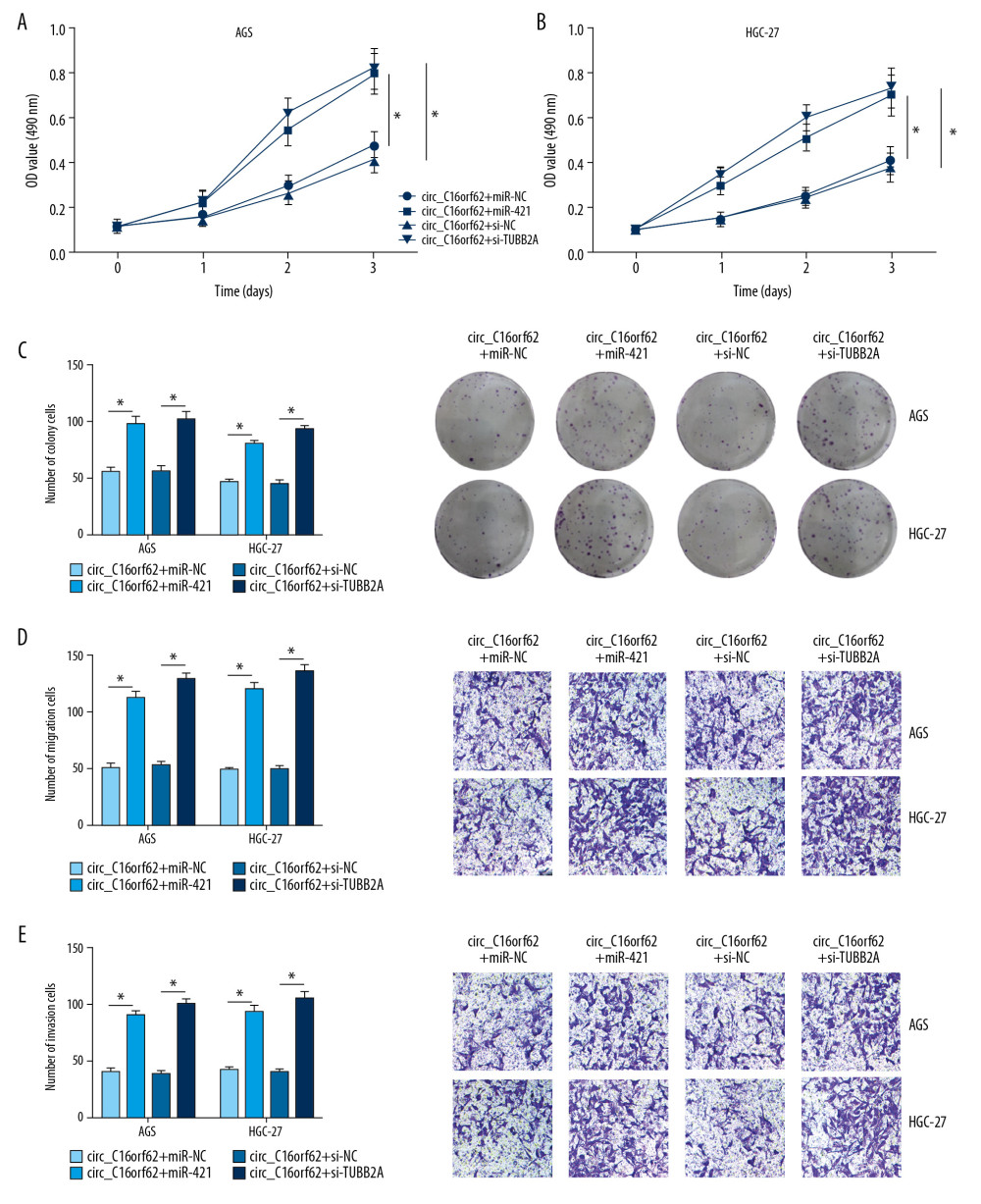 Circ_C16orf62 hindered tumor progression by miR-421/TUBB2A axis in GC cells. (A–C) Proliferation analysis was performed by MTT and colony formation assays in AGS and HGC-27 cells transfected with circ_C16orf62+ miR-NC, circ_C16orf62+ miR-421, circ_C16orf62+ si-NC and circ_C16orf62+si-TUBB2A. (D, E) The analysis of migration and invasion was carried out by using transwell assay in transfected AGS and HGC-27 cells. * P<0.05.