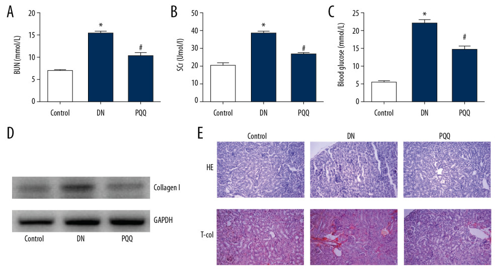 PQQ inhibits the structural and functional changes induced by STZ in DN. (A) Serum BUN. (B) Serum SCr. (C) Blood glucose. (D) Western blot detects collagen I expression. (E) H&E and T-col staining (magnification: 200×). * Compared with the control group, P<0.05; # Compared with the DN group, P<0.05. PQQ – pyrroloquinoline quinone; STZ – streptozocin; DN – diabetic nephropathy; BUN – blood urea nitrogen; SCr – serum creatinine; H&E – hematoxylin and eosin.