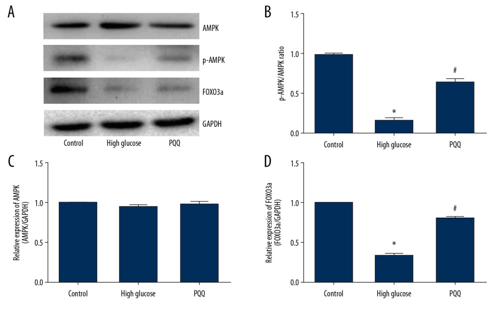 PQQ activates AMPK/FOXO3a pathway. (A) Western blot detects AMPK, p-AMPK, and FOXO3a expression. (B) p-AMPK/AMPK ratio. (C) AMPK mRNA. (D) FOXO3a mRNA. * Compared with the control group, P<0.05, # Compared with the high glucose group, P<0.05. PQQ – pyrroloquinoline quinone; AMPK – adenosine 5′-monophosphate-activated protein kinase; FOXO3a – forkhead box protein O3a; mRNA – messenger RNA.