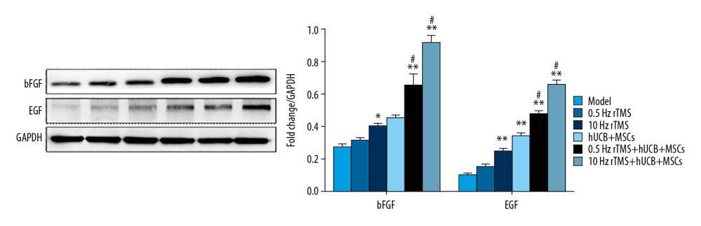 Effects of rTMS and hUCB-MSCs on the expression of bFGF and EGF proteins. Western blotting analysis, showing the expression of the neural stem cells proliferation related proteins bFGF and EGF. * p<0.05 and ** p<0.01 compared with rats subjected to SCI alone; # p<0.05 compared with rTMS. Bar in B=50 μm.