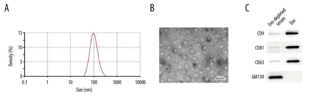 Identification of serum EVs. (A) Nanoparticle tracking analysis of serum EVs, represented as size vs. concentration. (B) Transmission electron microscope observed serum EVs. Scale bar=100 nm. (C) Representative immunoblots indicated that EVs isolated from blood serum of present enrichment of EVs markers CD9, CD81, and CD63 but do not contain Golgi matrix protein GM130, as detected by western blot analysis.