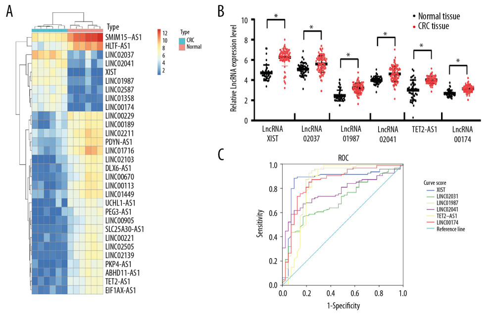 Upregulation of lncRNA XIST in serum EVs in CRC patients. Microarray analysis of different expressed lncRNAs in serum EVs in 6 healthy participants and 6 CRC patients. (A) Heat map of 30 differentially expressed lncRNAs. (B) RT-qPCR was performed to determine lncRNA XIST, linc02037, linc01987, linc02041, TET2-AS1, and linc00174 expression in serum EVs in 41 healthy participants and 94 CRC patients. (C) ROC analysis for expression of lncRNA XIST, linc02037, linc01987, linc02041, TET2-AS1, and linc00174. For lncRNA XIST, areas under the ROC curve: 0.864; sensitivity: 88.3%; and specificity: 90.2%; for linc02037, areas under the ROC curve: 0.698; sensitivity: 56.4%; and specificity: 82.9%; for linc01987, areas under the ROC curve: 0.856; sensitivity: 92.6%; and specificity: 78.0%; for linc02041, areas under the ROC curve: 0.774; sensitivity: 61.7%; and specificity: 90.2%; for TET2-AS1, areas under the ROC curve: 0.828; sensitivity: 95.7%; and specificity: 70.7%; for linc174, areas under the ROC curve: 0.849; sensitivity: 85.1%; and specificity: 78.0%.