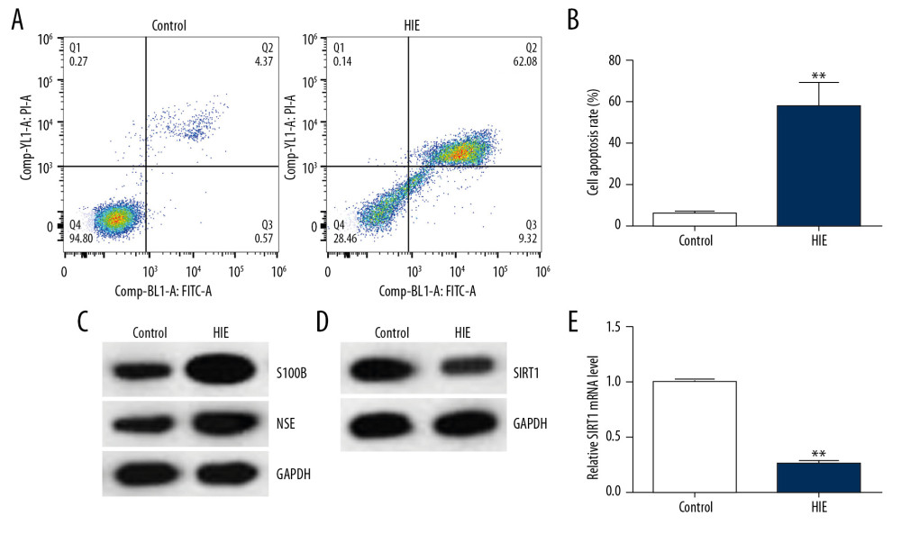 SIRT1 expression was downregulated in the HIE rat brain tissues. (A) Cell apoptosis of rat brain tissues was analyzed using flow cytometry. (B) Cell apoptosis rate was calculated and presented (n=5). (C) The levels of the related molecular markers S100B and NSE during the development of HIE were measured by Western blot. (D) Western blot analysis of SIRT1 levels. (E) qRT-PCR analysis of SIRT1 mRNA levels (n=5). The results showed as the mean ± SD. ** P<0.01 vs. control group. SIRT1 – sirtuin-1; HIE – hypoxic-ischemic encephalopathy; NSE – neuron-specific enolase; S100B – S100 calcium binding protein B.