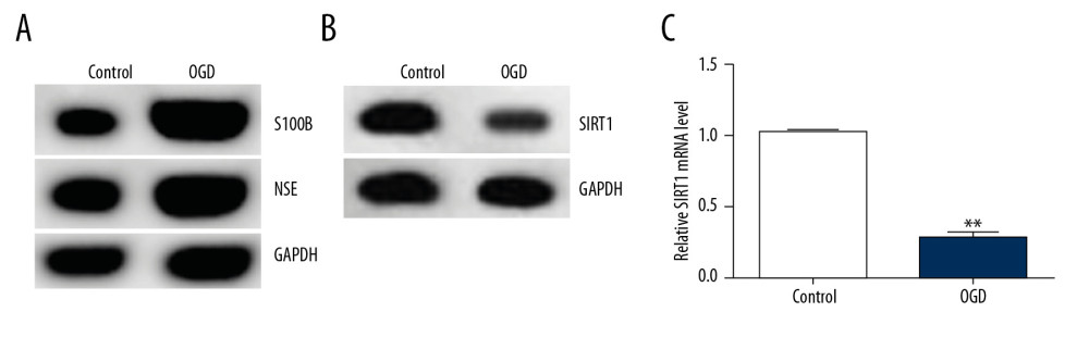 SIRT1 expression was downregulated in the OGD-induced primary rat neurons. (A) The protein expression levels of the related molecular markers S100B and NSE during the development of HIE were determined by Western blot assay. (B) SIRT1 protein levels were determined by Western blot assay. (C) SIRT1 mRNA gene expression was determined by qRT-PCR. Control: cells without any treatment; OGD: cells were stimulated with OGD. The results showed as the mean±SD. ** P<0.01 vs. control group. SIRT1 – sirtuin-1; OGD – oxygen and glucose deprivation.
