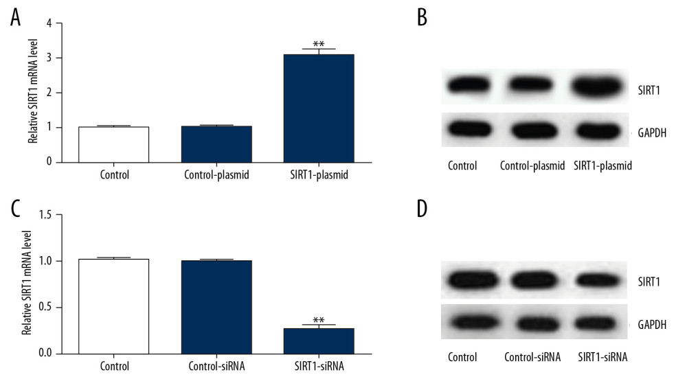 Transfection efficiency of SIRT1 overexpression (SIRT1-plasmid) or silencing (SIRT1-siRNA) in primary rat neuronal cells. SIRT1 protein levels and mRNA gene expression in primary rat neuronal cells transfected with SIRT1-plasmid or control-plasmid for 48 h were determined by (A) Western blot and (B) qRT-PCR assays, respectively. SIRT1 protein levels and mRNA gene expression in primary rat neuronal cells transfected with SIRT1-siRNA or control-siRNA for 48 h were determined by (C) Western blot and (D) qRT-PCR assays, respectively. Control – cells without any treatment; Control-plasmid: cells were transfected with control-plasmid; SIRT1-plasmid: cells were transfected with SIRT1-plasmid; Control-siRNA: cells were transfected with control-siRNA; SIRT1-siRNA: cells were transfected with SIRT1-siRNA. The results showed as the mean±SD. ** P<0.01 vs. control group. SIRT1 – sirtuin-1.
