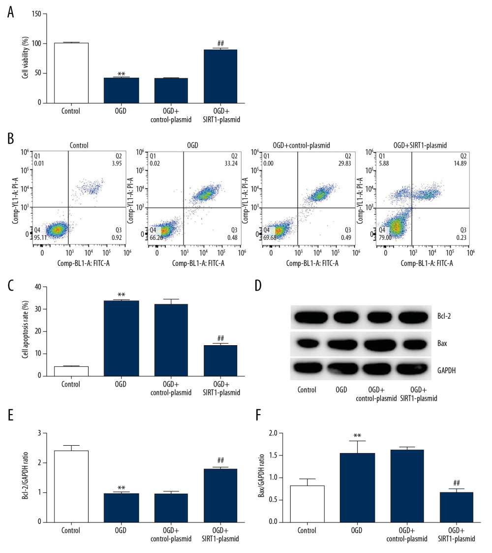 SIRT1 overexpression increased cell viability and decreased cell apoptosis in OGD-induced primary rat neuronal cells. Primary rat neuronal cells were transfected with SIRT1-plasmid or control-plasmid for 48 h, then the cells were exposed to OGD for 48 h. (A) Cell proliferation was assessed using MTT assay. (B) Flow cytometry was used to determine apoptotic cells. (C) Quantification of apoptotic cells. (D) Bax and Bcl-2 protein levels were determined by Western blot assay. (E, F) The ratio of Bcl-2/GAPDH and Bax/GAPDH was calculated and presented. Control: cells without any treatment; OGD: cells were subjected to OGD treatment; OGD+control-plasmid: cells were transfected with control-plasmid and then subjected to OGD treatment; OGD+SIRT1-plasmid: cells were transfected with SIRT1-plasmid and then subjected to OGD treatment. The results showed as the mean±SD. ** P<0.01 vs. control group; ## P<0.01 vs. OGD group. OGD – oxygen and glucose deprivation; SIRT1 – sirtuin-1.
