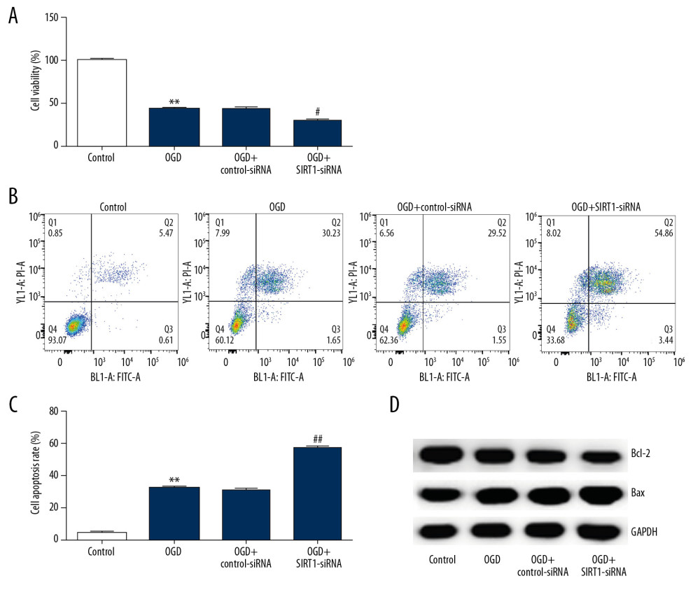 SIRT1 silencing decreased the viability and increased cell apoptosis in OGD-induced primary rat neuronal cells. Primary rat neuronal cells were transfected with SIRT1-siRNA or control-siRNA for 48 h, then the cells were treated with OGD for 48 h. (A) Cell viability was determined by MTT assay. (B, C) Cell apoptosis was determined by flow cytometry. (D) Bax and Bcl-2 protein levels were determined by Western blot assay. Control: cells without any treatment; OGD: cells were subjected to OGD treatment; OGD+control-siRNA: cells were transfected with control-siRNA and then subjected to OGD treatment; OGD+SIRT1-siRNA: cells were transfected with SIRT1-siRNA and then subjected to OGD treatment. The results are presented as the mean±SD. ** P<0.01 vs. control group; ## P<0.01 vs. OGD group. OGD – oxygen and glucose deprivation; SIRT1 – sirtuin-1.