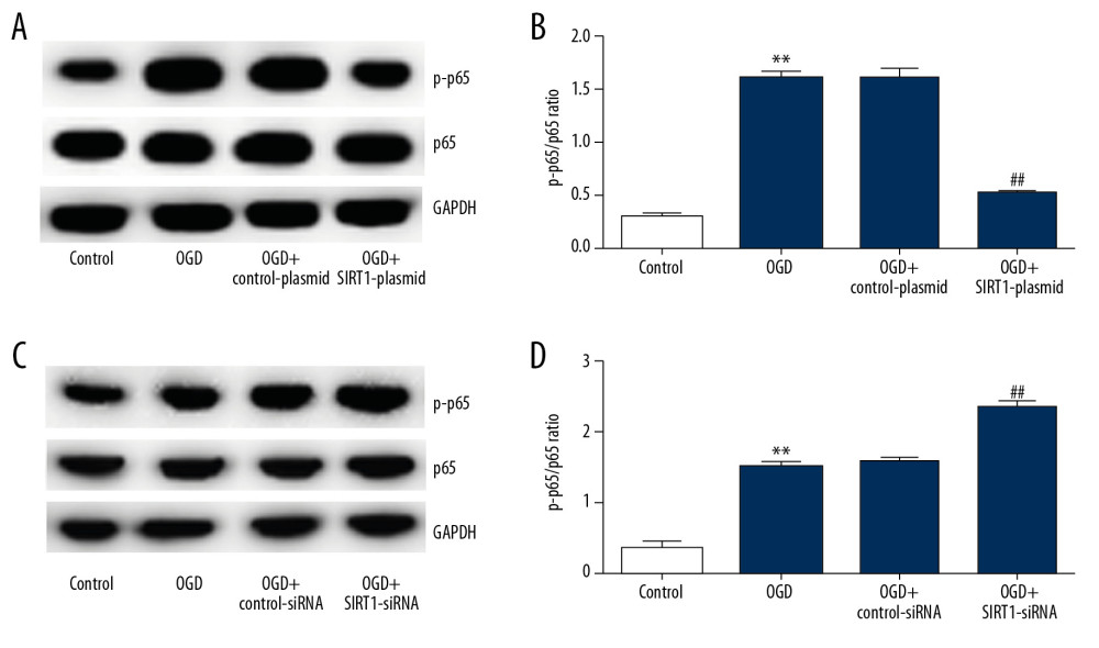 Effect of SIRT1 on NF-κB signaling pathway in OGD-induced neuronal cells. Primary rat neuronal cells were transfected with SIRT1-plasmid/SIRT1-siRNA or control-plasmid/control-siRNA for 48 h, then the cells were treated with OGD for 48 h. (A) p-p65 and p65 protein levels in neurons transfected with SIRT1-plasmid or control-plasmid for 48 h were determined by Western blot assay. (B) The ratio of p-p65/p65 in neurons transfected with SIRT1-plasmid or control-plasmid for 48 h was calculated and presented. (C) p-p65 and p65 protein levels in neurons transfected with SIRT1-siRNA or control-siRNA for 48 h were determined by Western blot assay. (D) The ratio of p-p65/p65 in neurons transfected with SIRT1-siRNA or control-siRNA for 48 h was calculated and presented. Control: cells without any treatment; OGD: cells were subjected to OGD treatment; OGD+control-plasmid: cells were transfected with control-plasmid and then subjected to OGD treatment; OGD+SIRT1-plasmid: cells were transfected with SIRT1-plasmid and then subjected to OGD treatment; OGD+control-siRNA: cells were transfected with control-siRNA and then subjected to OGD treatment; OGD+SIRT1-siRNA: cells were transfected with SIRT1-siRNA and then subjected to OGD treatment. The results are presented as the mean±SD. ** P<0.01 vs. control group; # P<0.05, ## P<0.01 vs. OGD group. OGD – oxygen and glucose deprivation; SIRT1 – sirtuin-1.