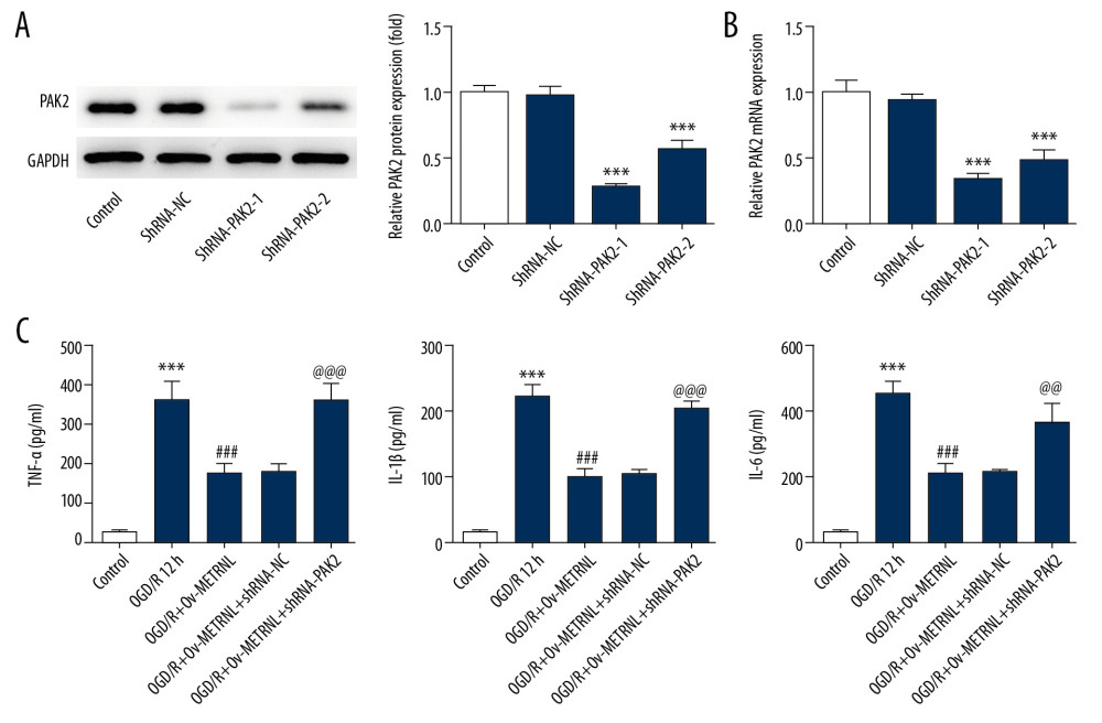 PAK2 silencing reversed the inhibitive effect of METRNL overexpression on inflammatory response. (A) The expression of PAK2 in H9C2 cells was determined by western blot. (B) Relative expression of PAK2 in H9C2 cells was evaluated by qRT-PCR. (C) The levels of inflammatory cytokines including TNF-α, IL-1β, and IL-6 were measured by corresponding ELISA kits. Error bars represent the mean±SEM from three independent experiments. *** P<0.001 versus Control; ### P<0.001 versus OGD/R 12 hours; @@ P<0.01, @@@ P<0.001 versus OGD/R+Ov-METRNL. PAK2 – p21-activated kinase 2; METRNL – Meteorin-like; qRT-PCR – quantitative real-time polymerase chain reaction; TNF – tumor necrosis factor; IL – interleukin; ELISA – enzyme-linked immunosorbent assay; SEM – standard error of the mean; OGD/R – oxygen-glucose deprivation and reperfusion.