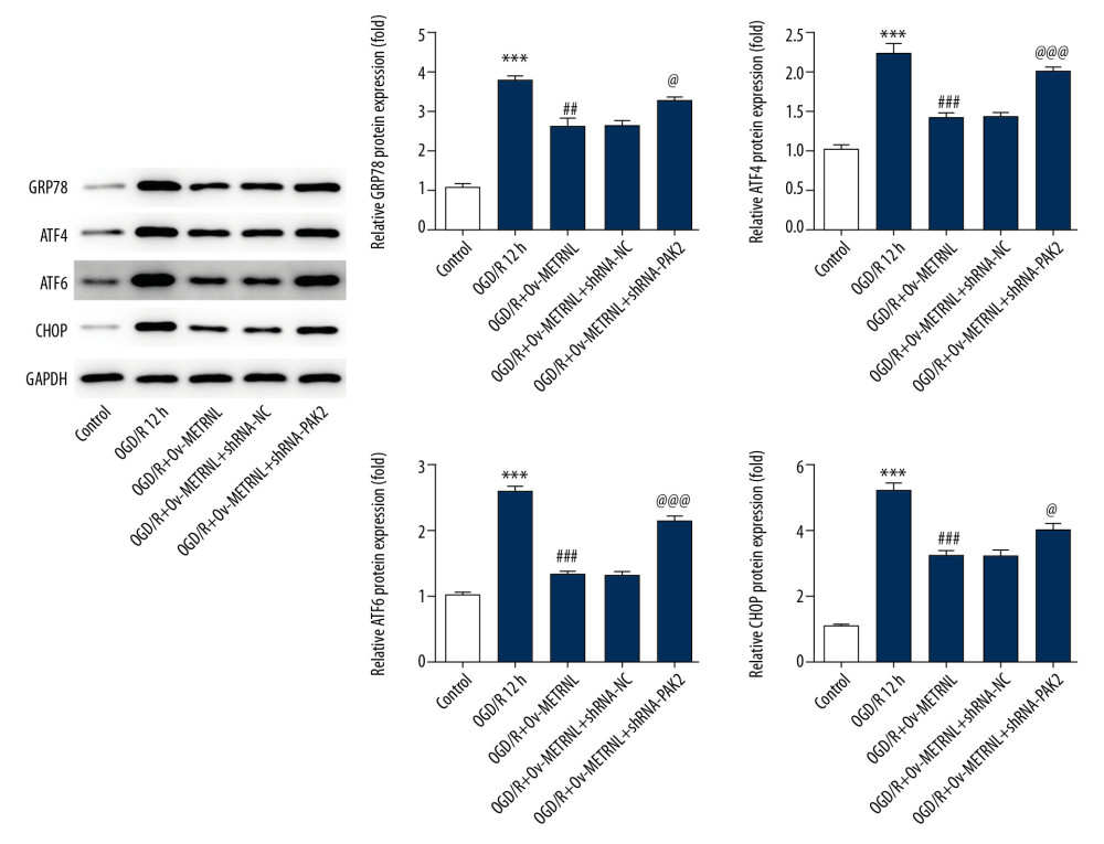 PAK2 silencing reversed the inhibitive effect of METRNL overexpression on c ER stress induced by OGD/R. The expressions of GRP78, ATF4, ATF6, and CHOP were determined by western blot. Error bars represent the mean±SEM from 3 independent experiments. *** P<0.001 versus Control; ## P<0.01, ### P<0.001 versus OGD/R 12 hours; @ P<0.05, @@@ P<0.001 versus OGD/R+Ov-METRNL. PAK2 – p21-activated kinase 2; METRNL – Meteorin-like; ER – endoplasmic reticulum; OGD/R – oxygen-glucose deprivation and reperfusion; GRP78 – glucose-regulated protein 78; ATF – activating transcription factor; CHOP – C/EBP-homologus protein; SEM – standard error of the mean.
