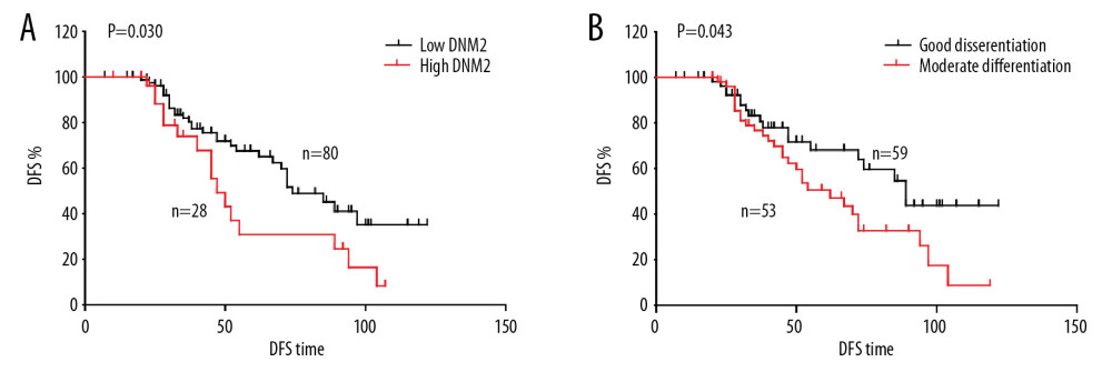 Correlation among disease-free survival (DFS), dynamin 2 (DNM2) expression, and differentiation. The DFS curves of DNM2 expression (A) and differentiation (B) were analyzed with the Kaplan-Meier method, and the statistical differences were calculated with the log-rank test.