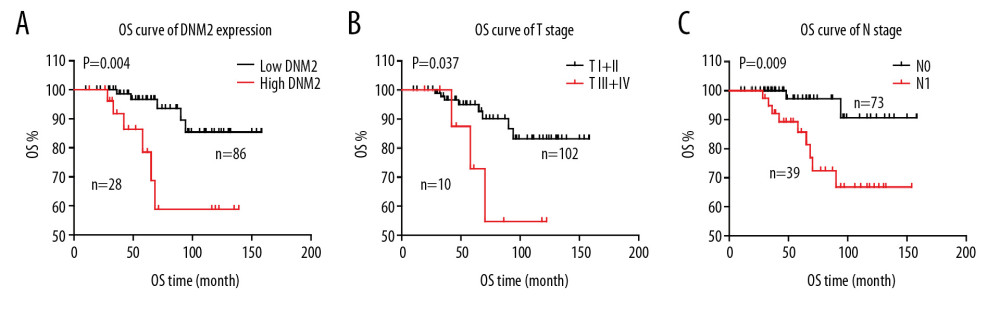Correlation among overall survival (OS), dynamin 2 (DNM2) expression, tumor (T) stage, and node (N) stage. The OS curves of DNM2 expression (A), T stage (B), and N stage (C) were analyzed with the Kaplan-Meier method, and the statistical differences were calculated with the log-rank test.
