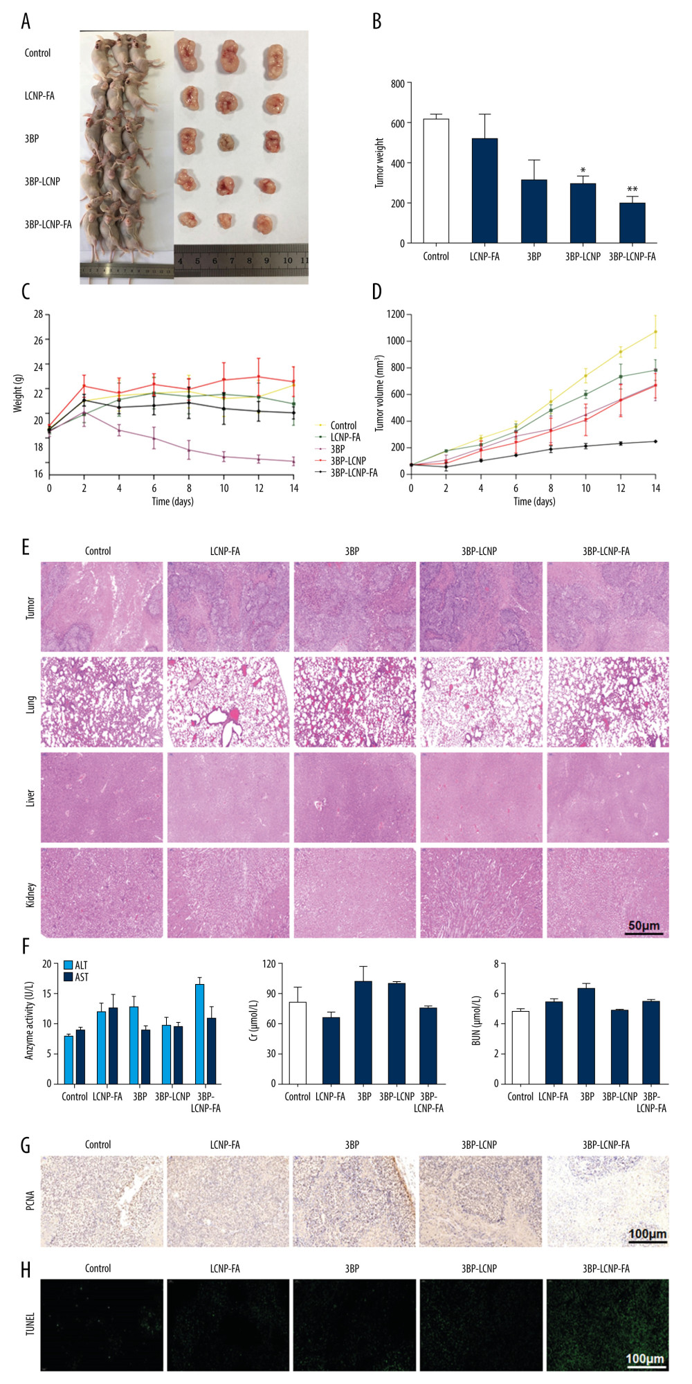 Antitumor activity evaluation of 3BP-LCNP-FA in vivo. (A) Formation of tumors in control, LCNP-FA, 3BP, 3BP-LCNP, and 3BP-LCNP-FA groups of mice. After nude mice were sacrificed in the last administration, tumor weights of different dosage groups were analyzed. (B) Data are presented as mean±S.D. (n=4) * P<0.05, ** P<0.01. (C) Change curves of mice weight and (D) tumor volume were measured at different time points after administration of different dosage forms. Data are presented as mean±S.D. (n=4). H &E staining of the tumors, lung, liver, and kidney after LCNP-FA, 3BP, 3BP-LCNP, and 3BP-LCNP-FA treatment vs. control. (E) The images are representative of three independent experiments. After LCNP-FA, 3BP, 3BP-LCNP, and 3BP-LCNP-FA treatment, the levels of AST, ALT, Cr, and BUN were evaluated by taking orbital venous blood. (F) Data represent the Mean±S.D. (n=6). PCNA immunohistochemistry of LCNP, 3BP, 3BP-LCNP, and 3BP-LCNP-FA treatment. (G) The images are representative of three independent experiments. TUNEL assay of LCNP, 3BP, 3BP-LCNP, and 3BP-LCNP-FA treatment. (H) The images are representative of three independent experiments.