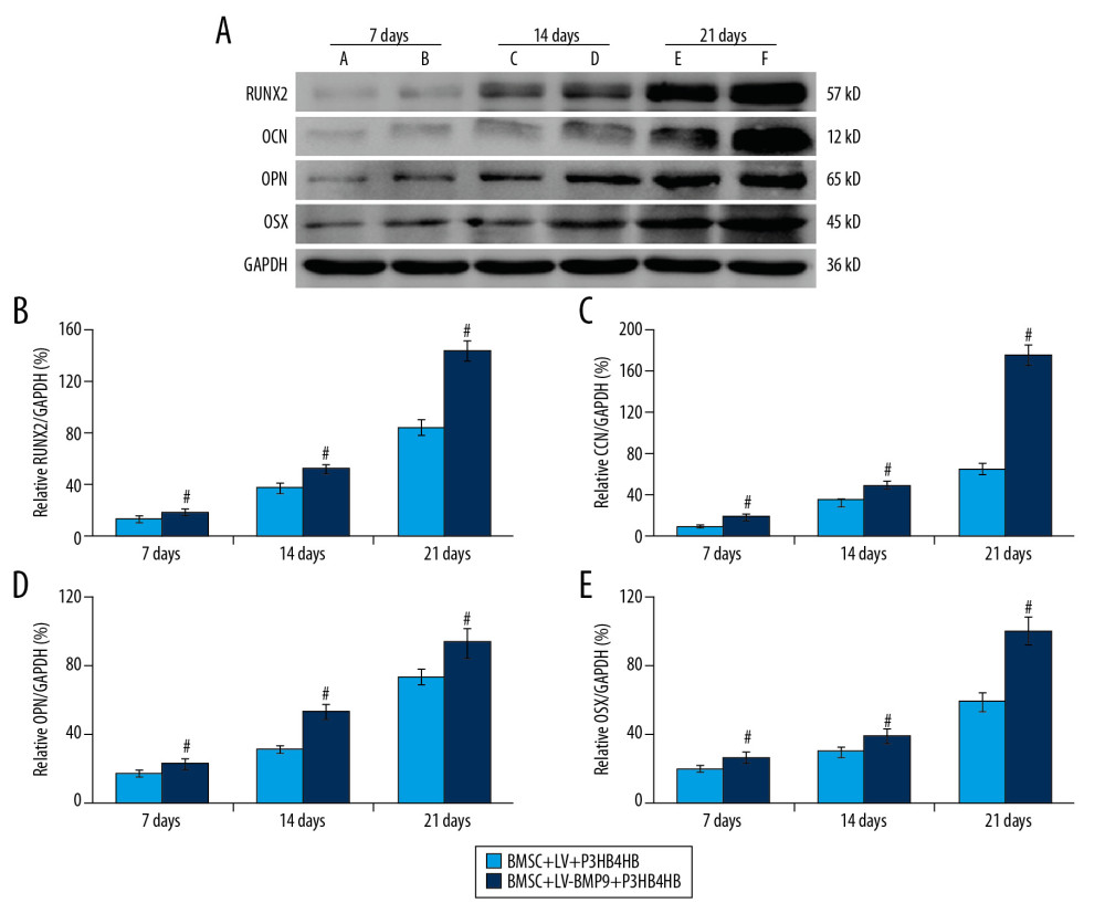 BMSCs-LV-BMP9-P3HB4HB composite bone repair material increased the expression of osteogenic factors, including BMP9, RUNX2, OCN, OPN, and OSX. (A) Expression of osteogenic factors evaluated by Western blot assay. (B) Effects of MSCs-LV-BMP9-P3HB4HB on RUNX2 expression. (C) Effects of MSCs-LV-BMP9-P3HB4HB on OCN expression. (D) Effects of MSCs-LV-BMP9-P3HB4HB on OPN expression. (E) Effects of MSCs-LV-BMP9-P3HB4HB on OSX expression. # p<0.05 versus the values of BMSC+LV-P3HB4HB group. BMSCs – bone mesenchymal stem cells; RUNX2 – runt-related transcription factor 2; OCN – osteocalcin; OPN – osteopontin; OSX – osterix; BMP9 – bone morphogenetic protein.