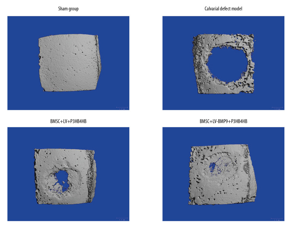 BMSC+LV-BMP9+P3HB4HB composite bone repair material demonstrated good repair ability for defect tissues of calvarial defect rats. The skull tissues in rat of sham group, calvarial defect model group, BMSC+LV+P3HB4HB group, and BMSC+LV-BMP9+P3HB4HB group are illustrated. BMSCs – bone mesenchymal stem cells.