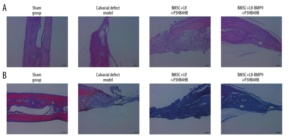 Changes of pathological injury and collagen fiber production in newly-formed tissues of calvarial defect rats. (A) Evaluation of pathological changes by H&E staining. (B) Determination of contents of collagen fibers by Masson’s trichrome staining.