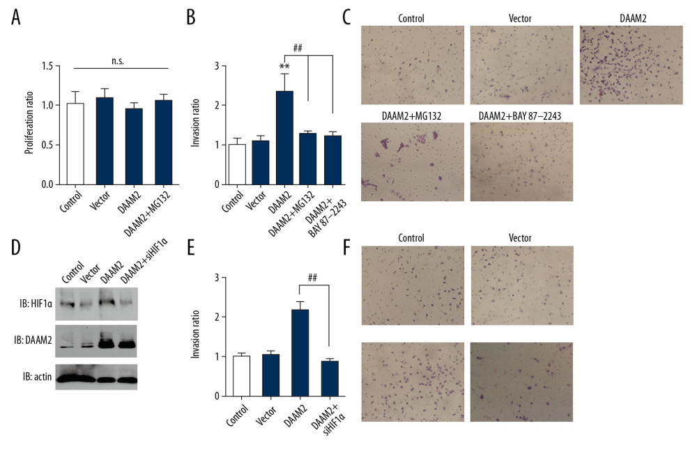 HIF-1α was required in DAAM2-induced invasion of HCC. (A) MG132 (10μM) incubation for 6 hr had no influence on proliferation of HuH7. Proliferation was assessed by MTT assay. (B) Invasion of HuH7 was detected after overexpressing DAAM2. 10 μM MG132 or 10 μM HIF-1α inhibitor BAY87-2243 was used to incubate HuH7. ** Represented P<0.01 compared with control group, and ## represented P<0.01 between indicated groups. Analyzed data were from three independent experiments. (C) Representative images in transwell assay of B. (D) Western blot showed that HIF-1α was knocked down while DAAM2 was overexpressed in HuH7. (E) HIF-1α knockdown extensively decreased the DAAM2-induced invasion. The invasion was detected with transwell assay. ## Represented P<0.01 between indicated groups. (F) Representative images in transwell assay of (E).