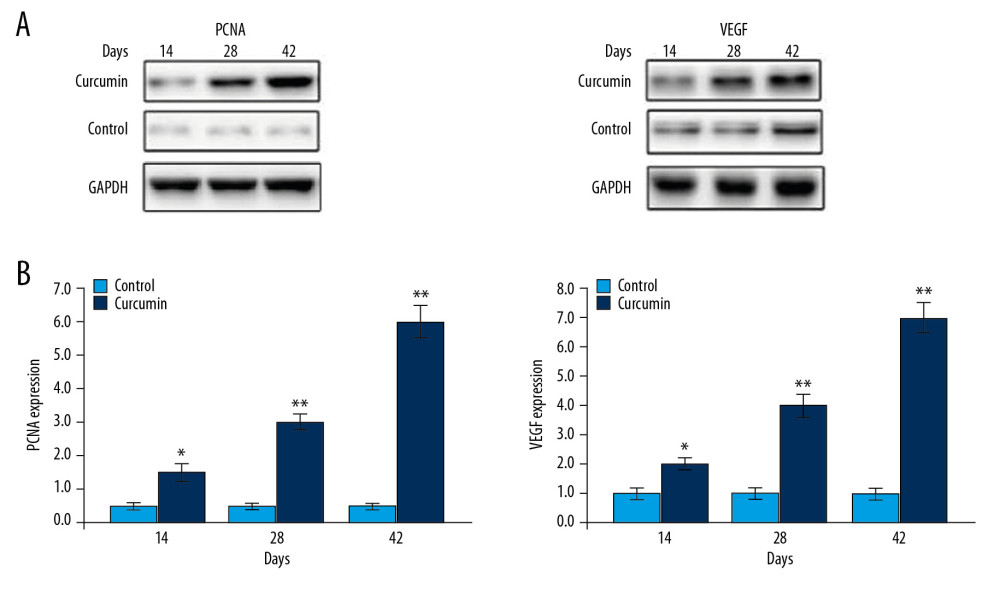 Curcumin promotes PCNA and VEGF expression. (A) The PCNA and VEGF levels in calluses of rats were assessed by western blotting on day 14, 28, and 42 post fractures. (B) The quantification of PCNA and VEGF levels was made taking GAPDH as loading control. * P<0.05, ** P<0.02 versus model (control) group. PCNA – proliferating cell nuclear antigen; VEGF – vascular endothelial growth factor; GAPHD – glyceraldehyde 3-phosphate dehydrogenase.