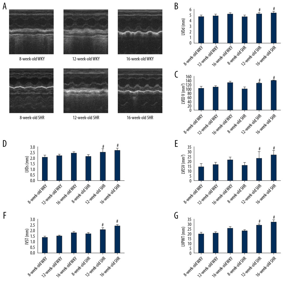 (A) Cardiac echocardiographic cycle in rats of different ages. (B–G) LVDd, LVEDV, LVDs, LVESV, IVST, and LVPWT in WKY rats and SHRs. * P<0.05 compared with 16-week-old WKY rats, and # P<0.05 compared with 8-week-old SHRs. SHRs – spontaneously hypertensive rats; WKY – Wistar-Kyoto; LVDd – left ventricular end diastolic diameter; LVEDV – left ventricular end-diastolic volume; LVDs – left ventricular end systolic diameter; LVESV – left ventricular end-systolic volume; IVST – interventricular septum thickness; LVPWT – left ventricular posterior wall thickness.