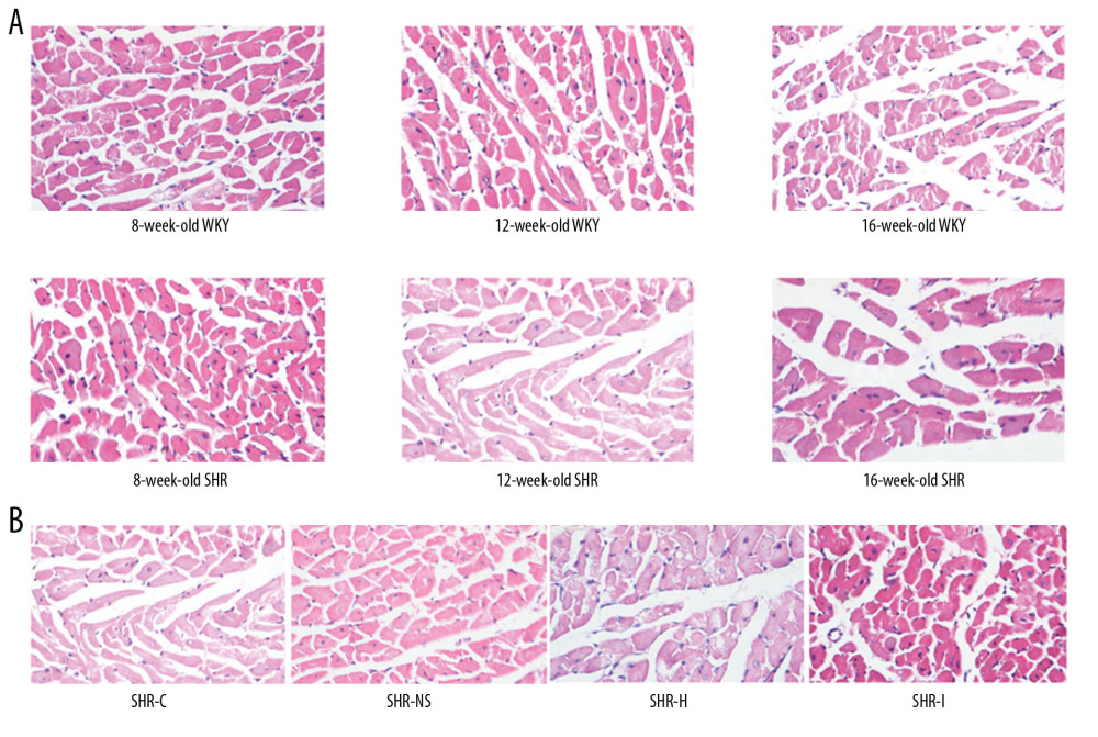 (A) Images of hematoxylin and eosin (H&E) staining of the myocardial tissue from rats of different ages. (B) Images of H&E staining of the myocardial tissue from rats in each experimental group.