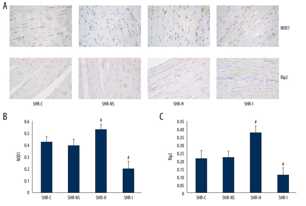 (A) Immunohistochemical staining showing the expression of the NOD1 and Rip2 proteins in the myocardium. (B, C) Semi-quantitative analysis of the expression of the NOD1 and Rip2 proteins in the myocardium from rats in each group measured using immunohistochemical staining. * P<0.05 compared with the SHR-C group, and # P<0.05 compared with the SHR-NS group. NOD1 – nucleotide-binding oligomerization domain 1; Rip2 – receptor-interacting protein 2; SHRs – spontaneously hypertensive rats; SHR-C group – control group; SHR-NS group – saline injection group.