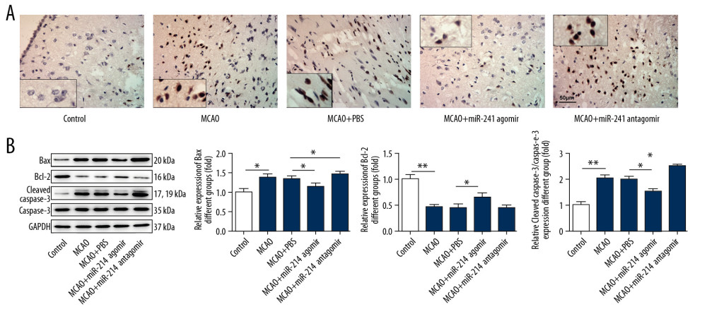 miR-214 relieved the apoptosis of brain cells. (A) TUNEL staining of brain tissues (400×). (B) The expression of apoptosis-related proteins in brain tissues was detected with Western blotting. * p<0.05; ** p<0.01.