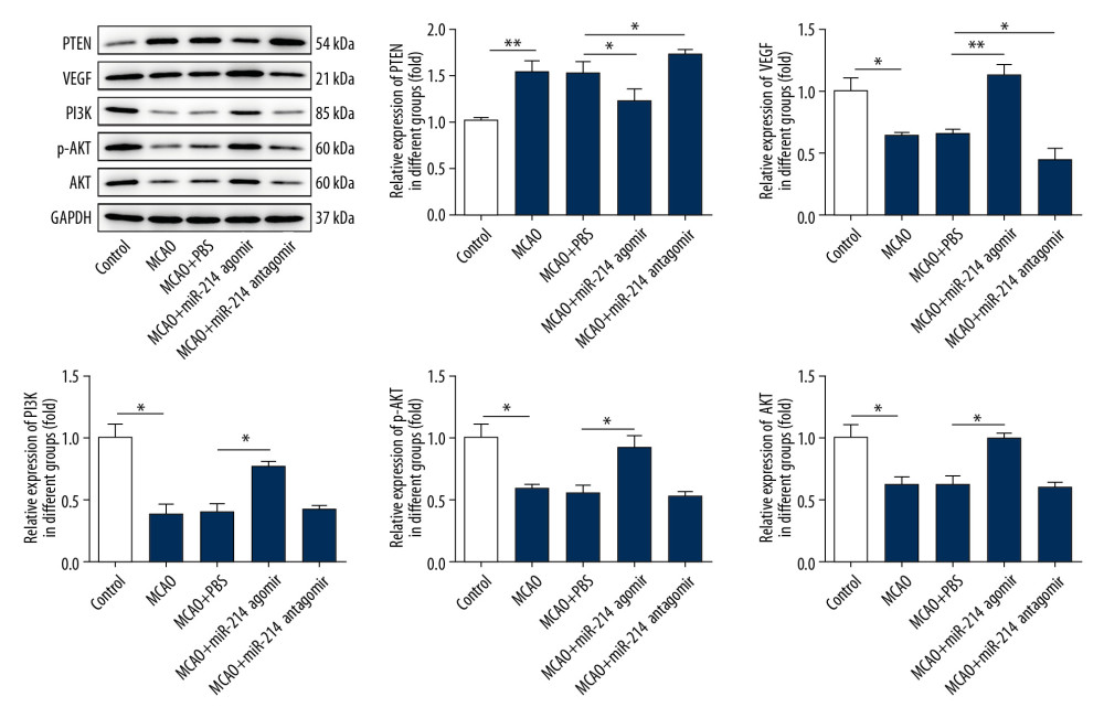 miR-214 alleviated cerebral ischemia-reperfusion injury by inhibiting the expression of PTEN and activating the PI3K/Akt pathway. The expression of PTEN, VEGF, PI3K, Akt, and p-Akt in brain tissues was determined by Western blotting. * p<0.05; ** p<0.01.