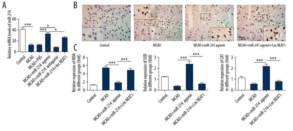 lncRNA NEAT1 attenuated the remission effect of miR-214 on cerebral ischemia-reperfusion injury. (A) The levels of miR-214 in brain tissues were determined by RT-PCR after overexpression of lncRNA NEAT1. (B) TUNEL staining was performed to detect apoptosis in brain tissues after the overexpression of lncRNA NEAT1. (C) The levels of MDA, SOD, and CAT in brain tissues were determined after the overexpression of lncRNA NEAT1. * p<0.05; *** p<0.001.