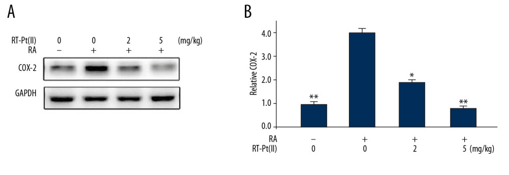 Effect of RT-Pt(II) on COX-2 level in RA rats. (A) The RA rats untreated or treated with RT-Pt(II) at 2 mg/kg and 5 mg/kg doses were assessed for COX-2 level on day 21 of the treatment. (B) Semi-quantified data. * P<0.02 and ** P<0.01 vs. untreated RA rats.