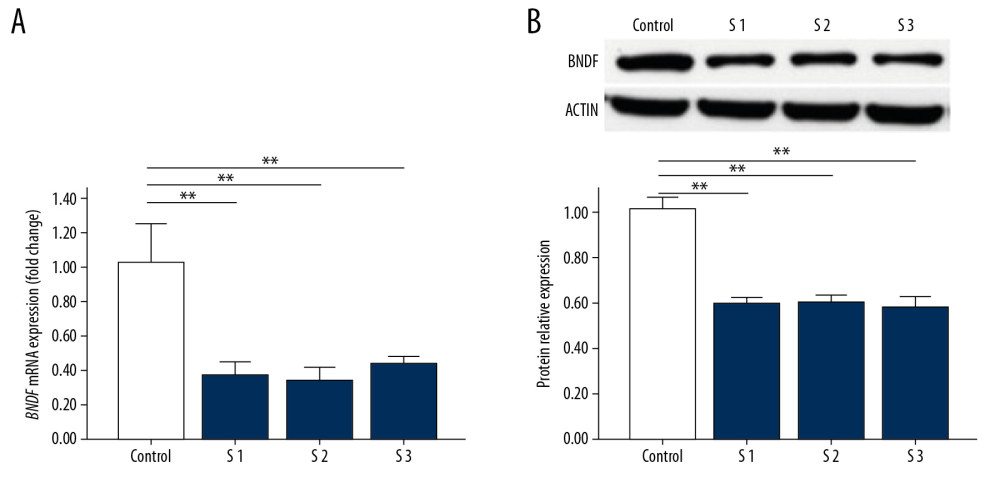 The expression of BDNF in the brains of mice sacrificed immediately after exposure to 2D-SWE. The relative mRNA expression of BDNF qRT-PCR (A). The protein levels of BDNF were assessed by western blot (B). The densitometric analysis of each band was performed using Image-Pro Plus 6.0, and protein expression levels were normalized to actin. Data are presented as the mean±SD from 3 independent experiments. Differences in measurement data were compared with one-way ANOVA. * P<0.05; ** P<0.01, and NS – no significance (P>0.05). BDNF – brain-derived neurotrophic factor; 2D-SWE – 2-dimensional shear wave elastography; mRNA – messenger RNA; qRT-PCR – quantitative real-time polymerase chain reaction; SD – standard deviation.