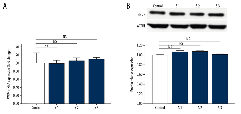 The expression of BDNF in the brains of mice sacrificed 24 hours after exposure to 2D-SWE. The relative mRNA expression levels of BDNF was detected by qRT-PCR (A). The protein expression levels of BDNF were quantified by western blots (B). The densitometric analysis of each band was performed using Image-Pro Plus 6.0, and the protein expression levels were normalized to those of actin. Data are presented as the mean±SD from 3 independent experiments. Differences in measurement data were compared with one-way ANOVA method. * P<0.05; ** P<0.01, and NS – no significance (P>0.05). BDNF – brain-derived neurotrophic factor; 2D-SWE – 2-dimensional shear wave elastography; mRNA – messenger RNA; qRT-PCR – quantitative real-time polymerase chain reaction; SD – standard deviation.
