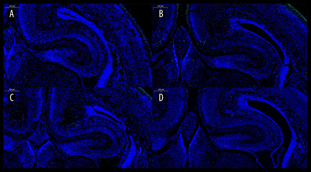 Image of the TUNEL test. The control group (A), Group S1 (B), Group S2 (C), and Group S3 (D). TUNEL – TdT-mediated dUTP nick-end labeling.