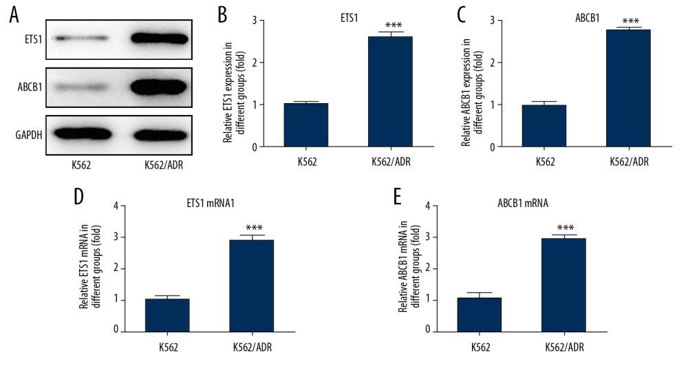The expression of ETS1 and ABCB1 in K562 and K562/ADR cell lines. (A) Representative immunoblot analysis of ETS1 and ABCB1. (B) Relative protein expression of ETS1 in K562/ADR cell line (n=3). (C) Relative protein expression of ABCB1 in K562/ADR cell line (n=3). (D) Relative mRNA expression of ETS1 in K562/ADR cell line (n=3). (E) Relative mRNA expression of ABCB1 in K562/ADR cell line (n=3). *** P<0.001 vs. K562 cell line.