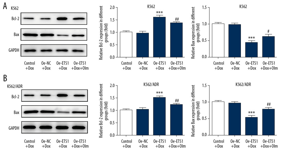 The effect of olmutinib on protein expression of Bcl-2 and Bax in K562 and K562/ADR cell lines overexpressing ETS1. (A) Representative immunoblot analysis together with relative protein expression of Bcl-2 and Bax in K562 cells (n=3). (B) Representative immunoblot analysis together with relative protein expression of Bcl-2 and Bax in K562/ADR cells (n=3). *** P<0.001 vs. Oe-NC+Dox; # P<0.05, ## P<0.01 and ### P<0.001 vs. Oe-ETS1+Dox. Oe-NC – overexpression-negative control; Oe-ETS1 – overexpression-ETS1; Dox – doxorubicin; Olm – olmutinib.
