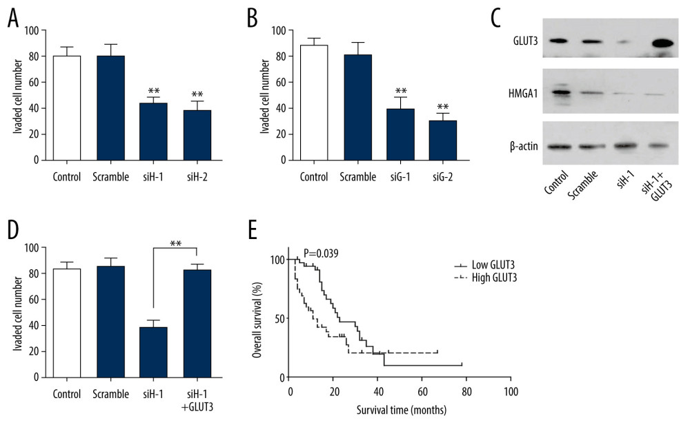 GLUT3 was required in HMGA1-induced invasion. (A, B) HMGA1 (A) or GLUT3 (B) knockdown significantly impaired the invasion of SW480. The invasion of SW480 was detected with transwell assay.(C) SW480 cells were transfected with GLUT3 plasmid for rescue assay in the presence of HMGA1 knockdown. (D) GLUT3 overexpression rescued the invasion decrease caused by HMGA1 knockdown. (E) High GLUT3 in CRCLM was significantly associated with poorer prognosis.