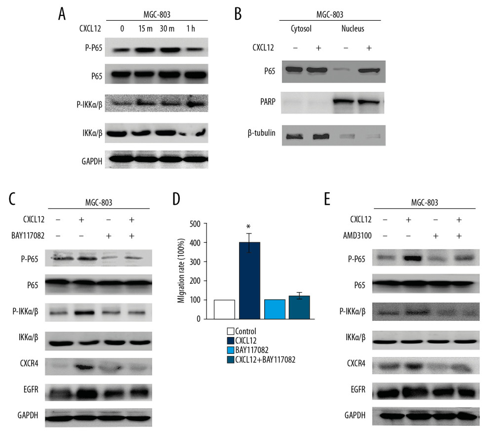 NF-κB transcription factor contributes to CXCL12/CXCR4-mediated EGFR upregulation. (A) MGC-803 cells were treated with CXCL12 (100 ng/mL). Phosphor-p65/IKKα/β were determined by western blot assay (m, minute; h, hour). (B) MGC-803 cells were incubated with CXCL12 (100 ng/mL) for 1 h. Nuclear and cytoplasm cell lysate proteins were analyzed by western blot assay. (C) MGC-803 cells were treated with CXCL12 (100 ng/mL) for 48 h and pretreated with or without BAY117082 (15 μM). Western blot analysis of EGFR and CXCR4. (D) MGC-803 cells were treated with CXCL12 (100 ng/mL) with or without BAY117082 (15 μM). Cell migration was examined by Transwell assay. Values are represented as mean±standard deviation (SD) in 3 independent experiments (* P<0.05). (E) MGC-803 cells were treated with CXCL12 (100 ng/mL) for 48 h and pretreated with or without AMD3100 (10 μg/mL). Western blot analysis of phosphor-p65/IKKα/β, EGFR, and CXCR4.
