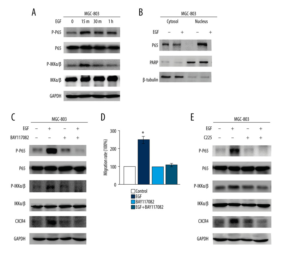 NF-κB transcription factor contributes to EGF/EGFR-mediated CXCR4 upregulation. (A) MGC-803 cells were treated with EGF (100 ng/mL). Phosphor-p65/IKKα/β were determined by western blot assay (m, minute; h, hour). (B) MGC-803 cells were incubated with EGF (100 ng/mL) for 1 h. Nuclear and cytoplasm cell lysate proteins were analyzed by western blot assay. (C) MGC-803 cells were treated with EGF (100 ng/mL) for 48 h and pretreated with or without BAY117082 (15 μM). Western blot analysis of CXCR4. (D) MGC-803 cells were treated with EGF (100 ng/mL) with or without BAY117082 (15 μM). Cell migration was examined by Transwell assay. Values are represented as mean±standard deviation (SD) in 3 independent experiments (* P<0.05). (E) MGC-803 cells were treated with EGF (100 ng/mL) for 48 h and pretreated with or without C225 (10 μg/mL). Western blot analysis of phosphor-p65/IKKα/β and CXCR4.