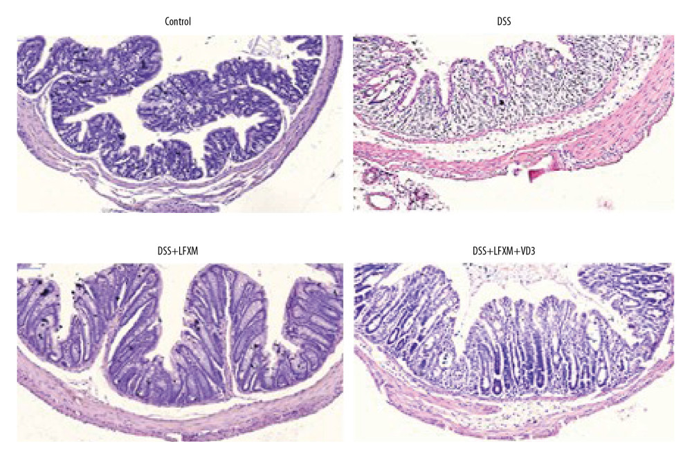 VD3 changed rifaximin’s effects on the histological characterization in DSS-colitis mice. Representative HE staining of the distal colonic tissues in the control group, DSS group, DSS+rifaximin group, and DSS+rifaximin+VD3 group. Five-μm cross-sections were fixed by formalin and embedded in paraffin, then stained with primary antibody. Scale bar: 100 μm.
