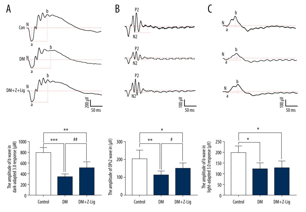 Z-LIG protects diabetic rat retinal function. (A) Amplitude of b wave (dark-adaptation 3.0 response). (B) Amplitude of OPs2 wave (dark-adaptation 3.0 response). (C) Amplitude of b-wave (light-adaptation 3.0 response). Values are presented as mean±standard deviation, n=12. * P<.05, ** P<.01, *** P<.001: DM group, DM+Z-LIG group vs. control group; # P<.05, ## P<.01: DM+Z-LIG group vs. DM group.