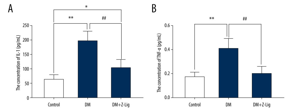 Z-LIG decreases retina IL-1 and TNF-α levels induced by diabetes after 12 weeks of treatment. (A) The concentration of IL-1. (B) The concentration of TNF-α. Values are presented as mean±SD, n=4. * P<.05, ** P<.01: DM group, DM+Z-LIG group vs. control group; ## P<.01: DM+Z-LIG group vs. DM group.