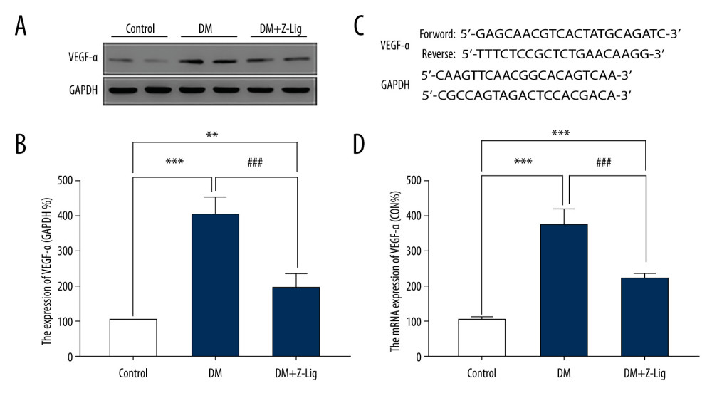 Z-LIG decreases diabetes-induced expression of VEGF-α in protein and mRNA in the retina after 12 weeks of treatment. (A) VEGF-α representative western blots with the respective loading control (GAPDH). (B) The protein expression of VEGF-α (GAPDH%). (C) The primers of VEGF-α. (D) The mRNA expression of VEGF-α (CON%). Data are presented as percentage of control and values are presented as mean ± standard deviation, n=4. ** P<.01, *** P<.001: DM group, DM+Z-LIG group vs. control group; ### P<.001: DM+Z-LIG group vs. DM group.