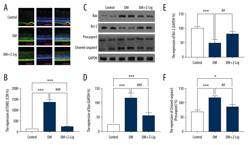 Z-LIG attenuates retinal cell apoptosis after 12 weeks of treatment. (A) Representative TUNEL images. (B) Expression of TUNEL (CON%). (C) Representative Western blots (BAX, bcl-2, procaspase and cleaved-Caspase-3), with their respective loading controls (GAPDH). (D) Relative density of immunoblot of BAX. (E) Relative density of immunoblot of bcl-2. (F) Relative density of immunoblot of cleaved-Caspase-3. Data are presented as percentage of control (or pro-Caspase-3) and values are presented as mean±SD, n=4. * P<.05, *** P<.001: DM group, DM+Z-LIG group vs. control group; ## P<.01, ### P<.001: DM+Z-LIG group vs. DM group.