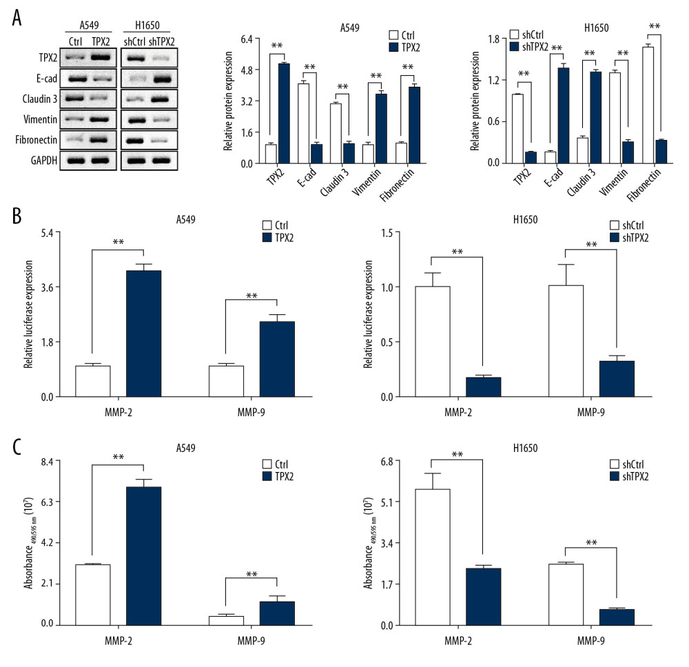 Correlations of TPX2 with EMT and MMPs in NSCLC cells. (A) The expression of epithelial marker proteins was consistent with TPX2 content, whereas the expression of mesenchymal marker proteins was opposite the expression of TPX2. (B) Luciferase reporter assay results suggested that TPX2 promoted the transcriptional activities of MMP2 and MMP9. (C) The enzyme activities of MMP2 and MMP9 were detected by using the activity detecting kit. Expression of both MMP2 and MMP9 activities was significantly higher in the TPX2 overexpression group of A549 cells, whereas in the knockdown group of H1650 cells, the MMP2 and MMP9 activities were significantly decreased when TPX2 was knocked down (mean±SD; n=3 in triplicate; ** P<0.01).