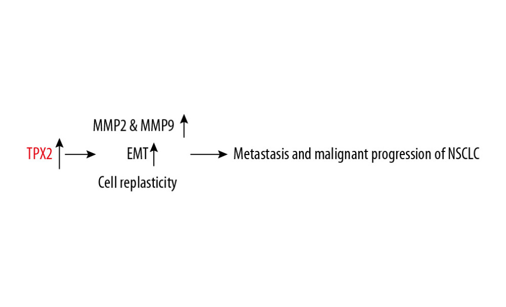 Proposed regulatory mechanism of TPX2 in the metastasis and malignant progression of NSCLC.
