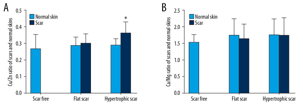 (A) The Cu/Zn ratio in individuals’ scar tissues compared with that in their NS. (B) The Ca/Mg ratio in individuals’ scar tissues compared with that in their NS. * P<0.05 compared with NS.